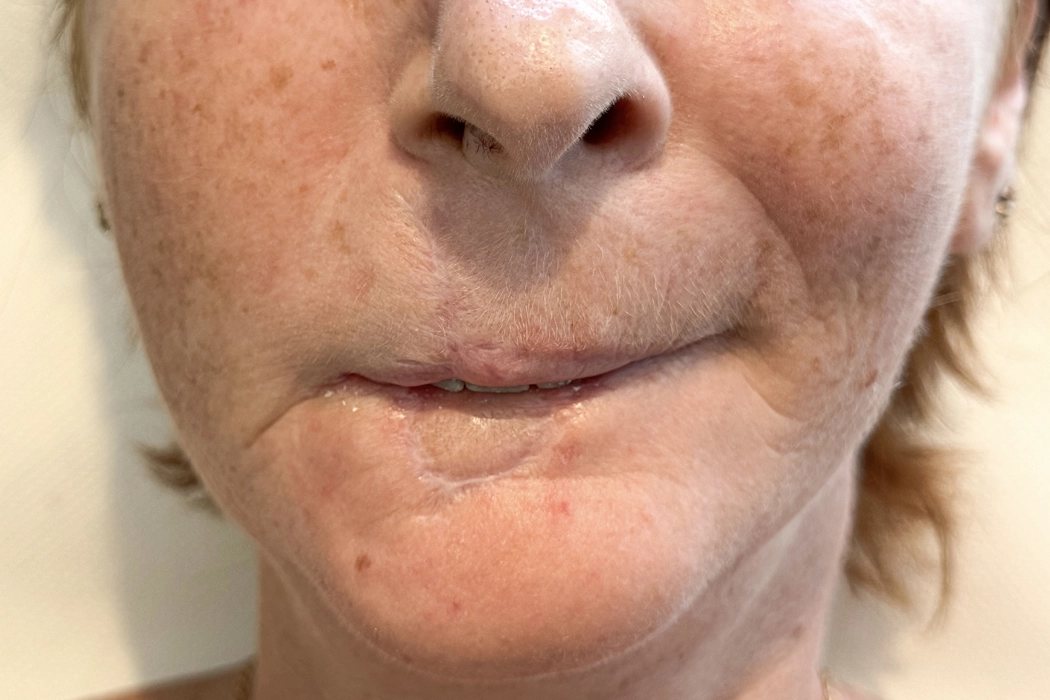 Clinicaderm • Stéphanie Sportes | Malformations et reconstructions du visage