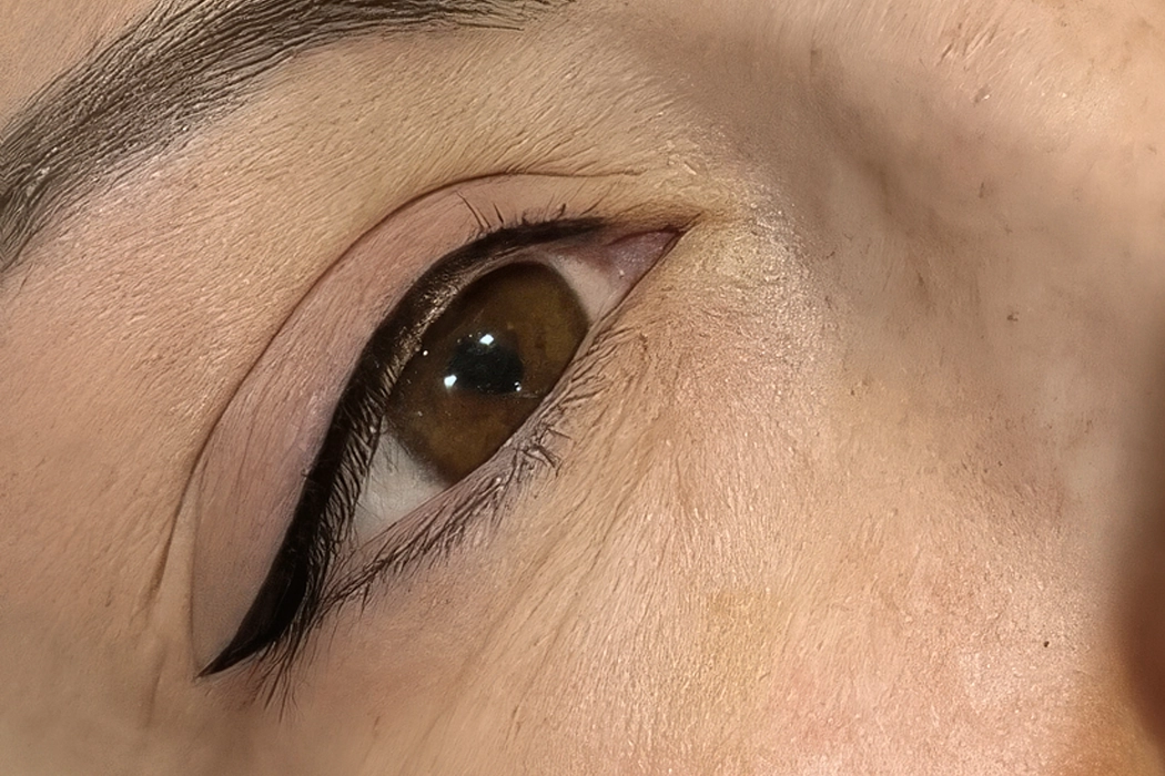 Clinicaderm • Stéphanie Sportes | Regard – correction et restauration visuelle