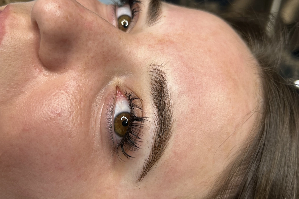 Clinicaderm • Stéphanie Sportes | Sourcils – correction et restauration visuelle