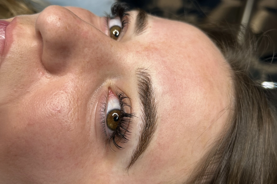 Clinicaderm • Stéphanie Sportes | Sourcils – correction et restauration visuelle