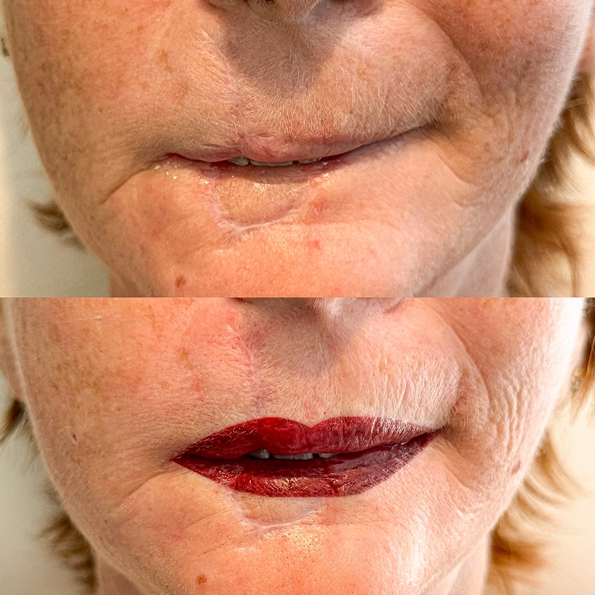 Clinicaderm • Stéphanie Sportes | reconstructions faciales