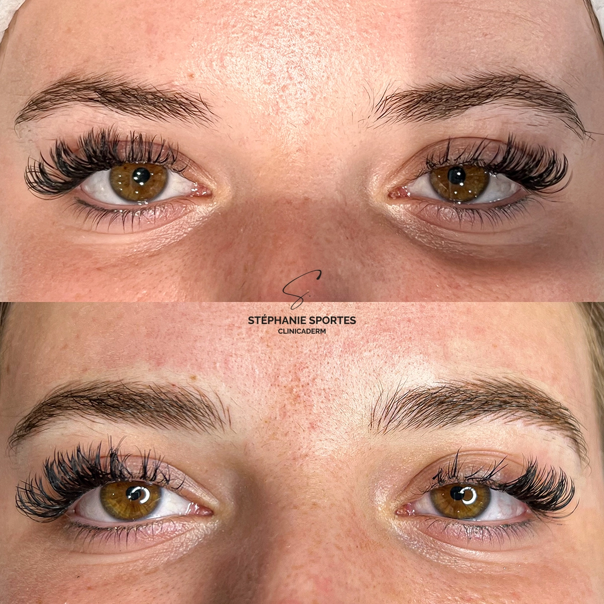 Clinicaderm • Stéphanie Sportes | Microblading