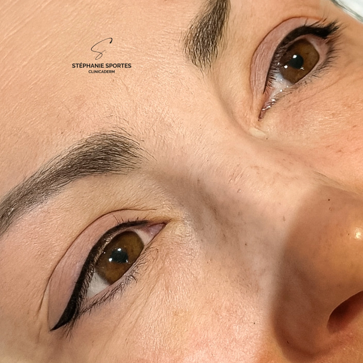 Clinicaderm • Stéphanie Sportes | Liner – correction et restauration visuelle